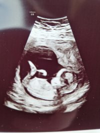 20240305_111742.jpg 20240305_111742.jpg