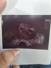 1000025354.jpg 1000025354.jpg