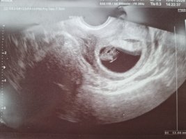 1000016213.jpg 1000016213.jpg