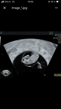 IMG_1852.png IMG_1852.png