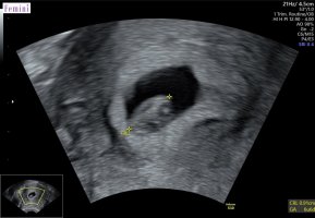 IMG_9688.jpeg IMG_9688.jpeg