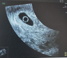 IMG_2436.jpeg IMG_2436.jpeg