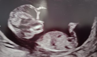 IMG_20250402_104242160 (1).jpg