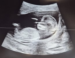 1000015668.jpg 1000015668.jpg