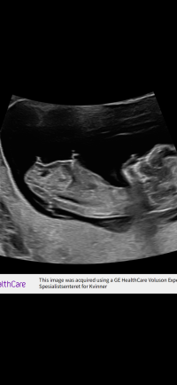 IMG_8402.png IMG_8402.png