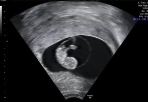 IMG_6720.jpeg IMG_6720.jpeg