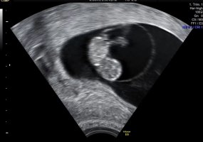 IMG_6719.jpeg IMG_6719.jpeg