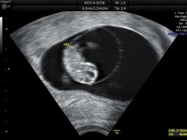 IMG_6717.jpeg IMG_6717.jpeg