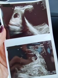 1000025641.jpg 1000025641.jpg