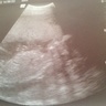 BabyApril13